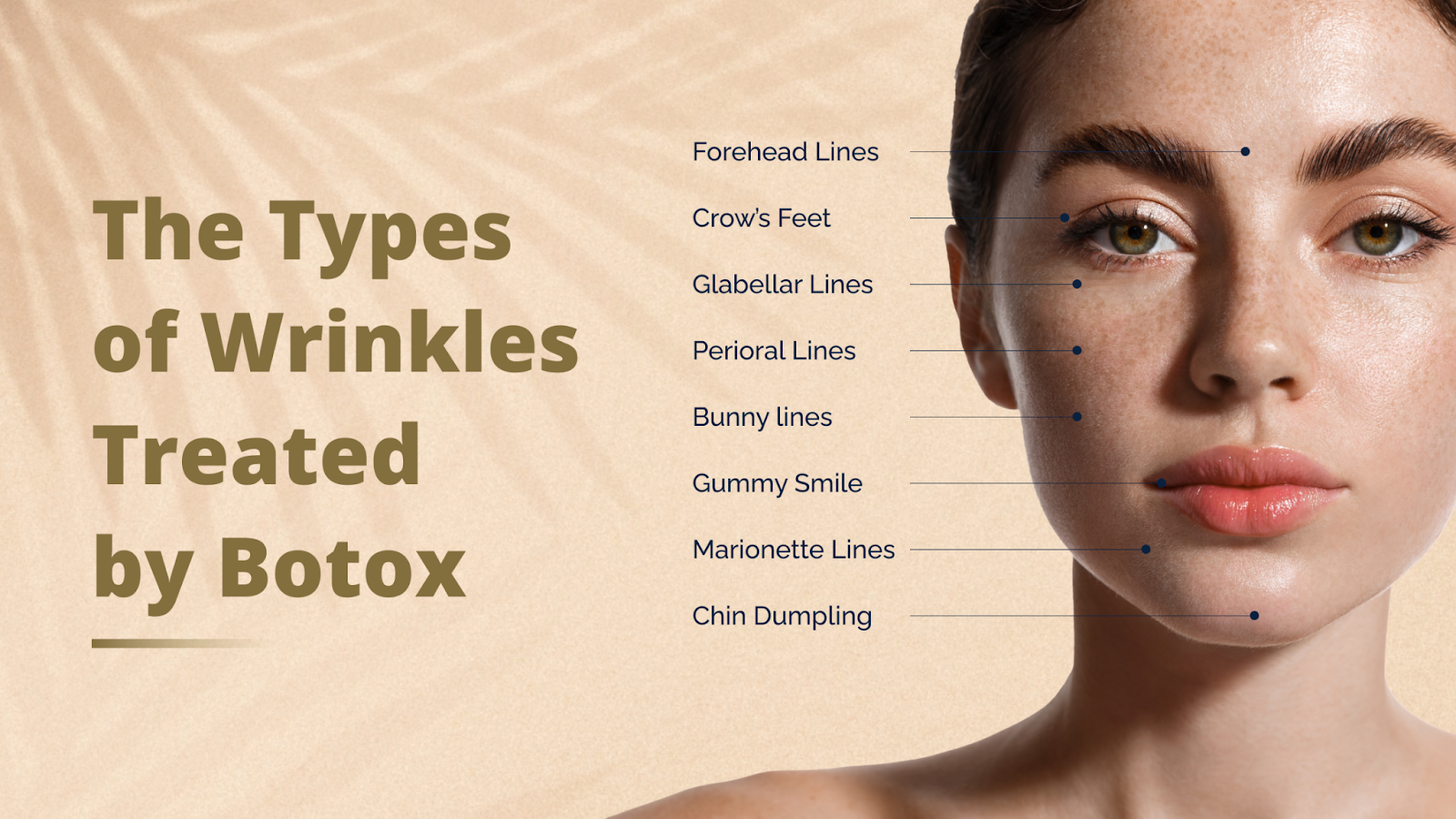The Types of Wrinkles Treated by Botox