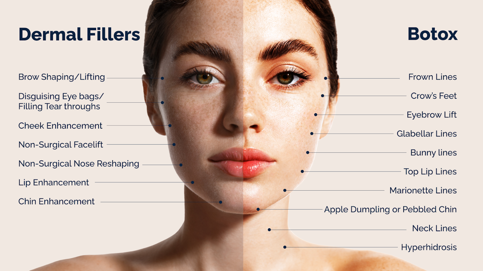 dermal fillers vs botox