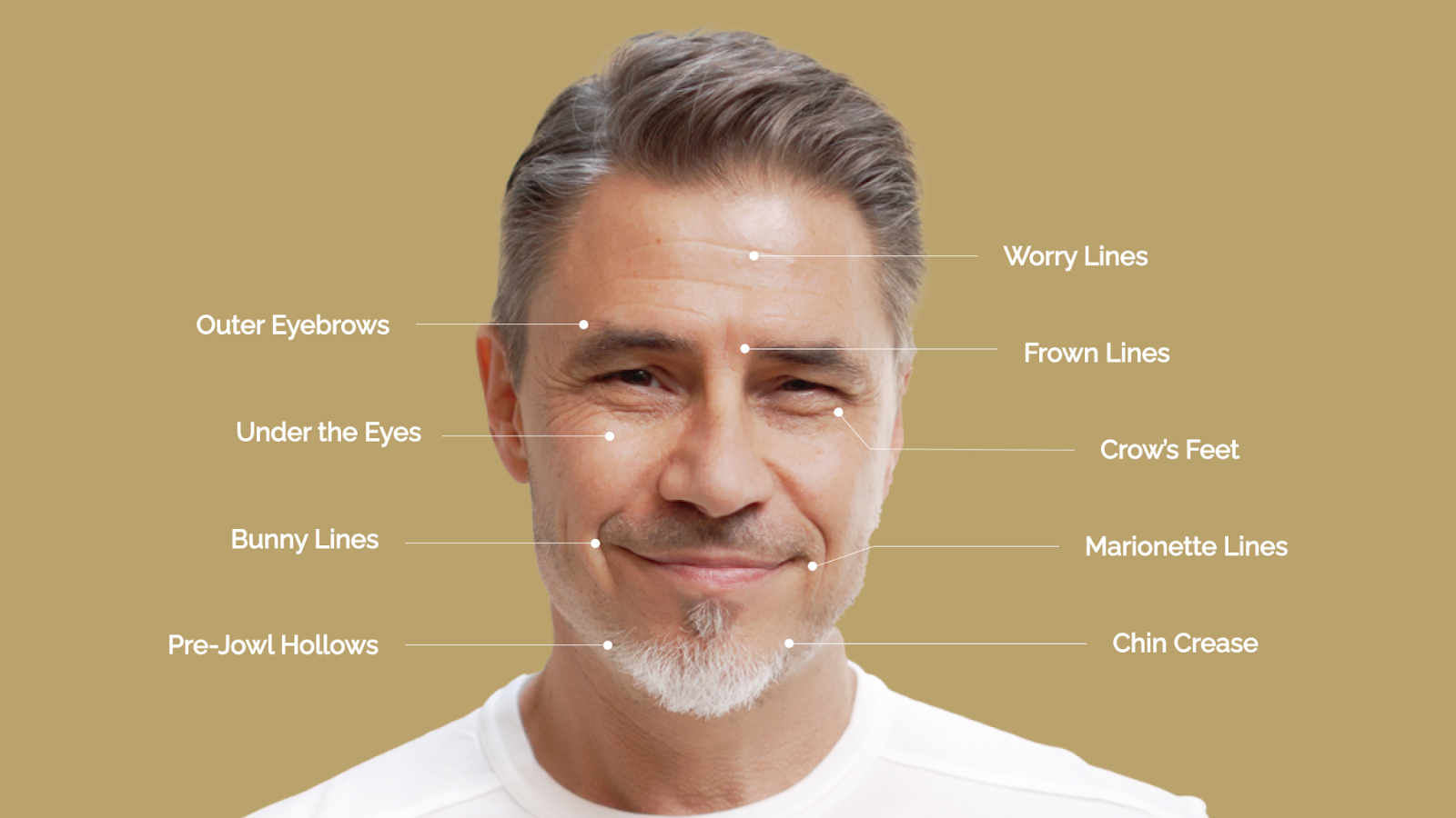 Common Botox Treatment Areas for Men